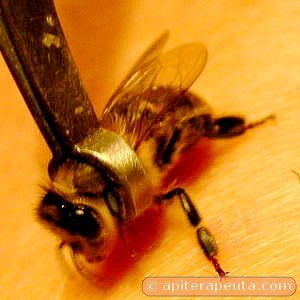 apiterapia con veneno de abeja HD